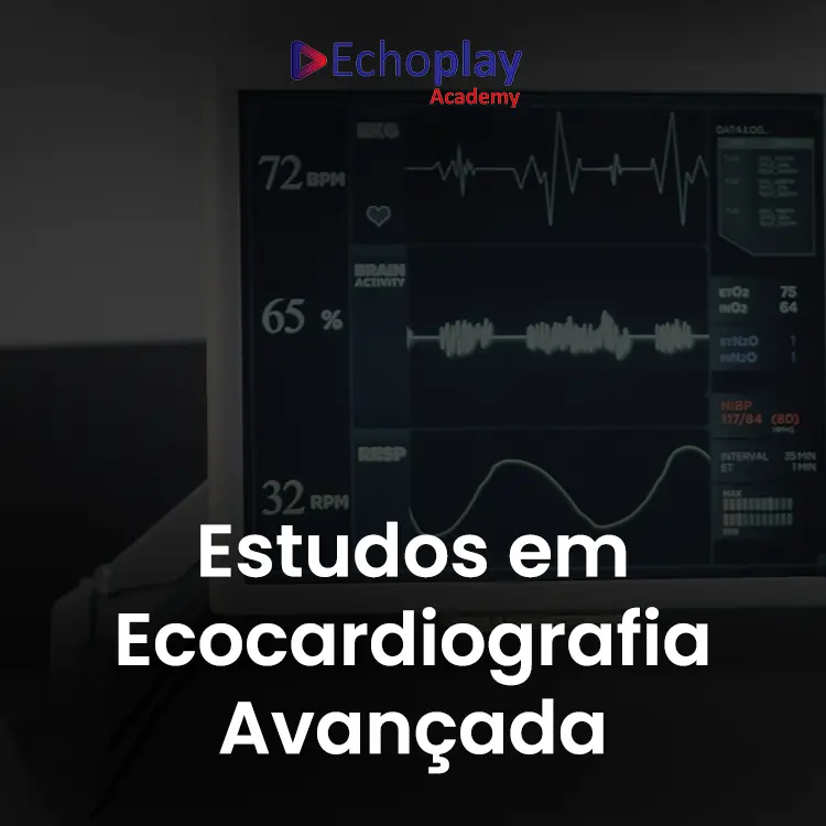 IMG ECHOPLAY ACADEMY 01